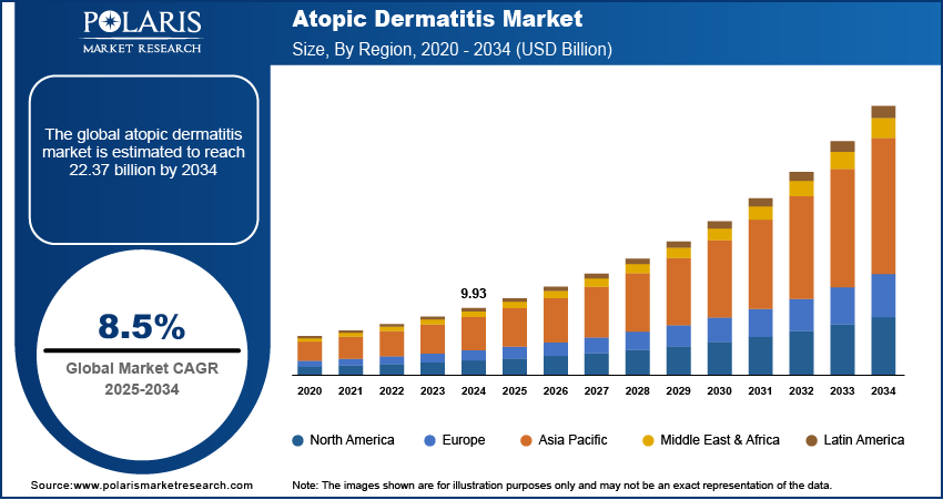 Atopic Dermatitis Market Size